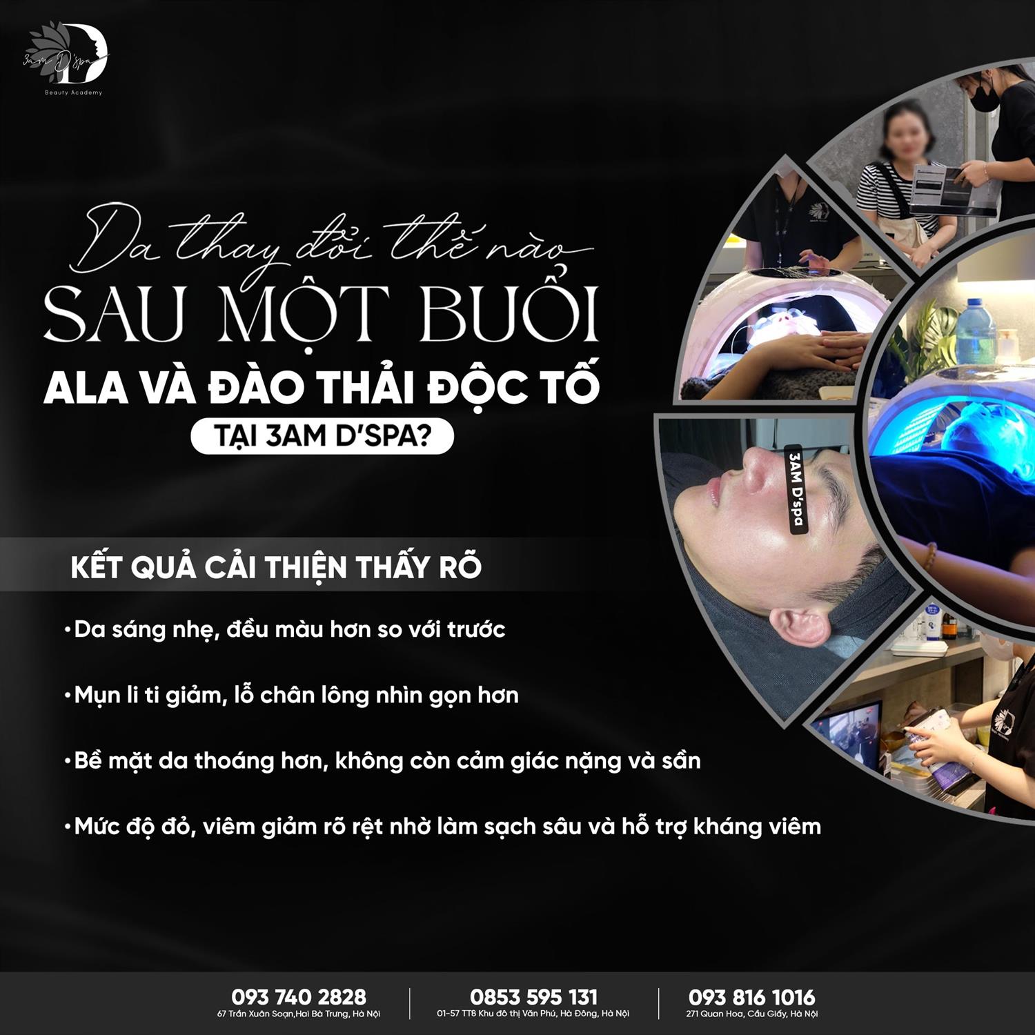  Da thay đổi thế nào sau một buổi ALA và Đào thải độc tố tại 3AM D’spa?