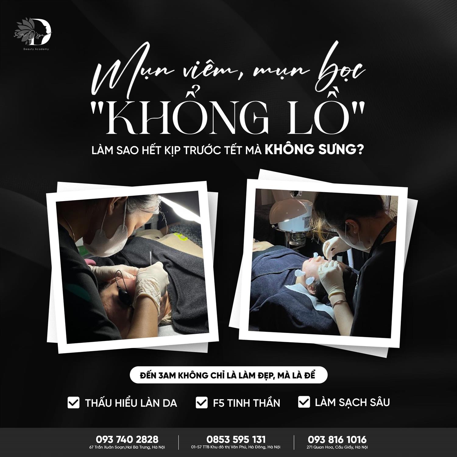 MỤN VIÊM, MỤN BỌC 