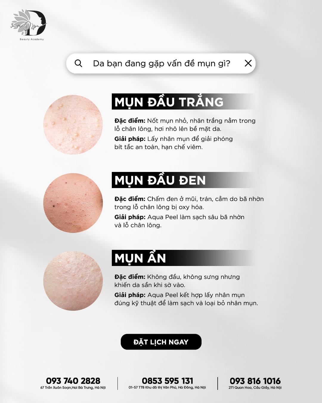 Bạn có biết: 80% trường hợp trị mụn thất bại là do 