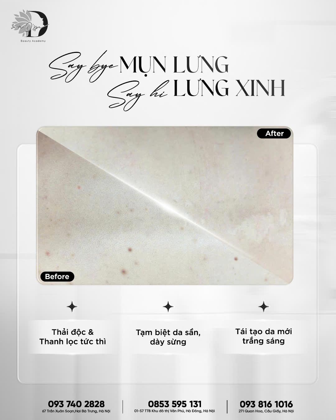 Nếu bạn đang khổ sở vì lưng thô ráp, dày sừng khiến bản thân mất tự tin khi diện những chiếc váy hở lưng quyến rũ, thì VI TẢO LƯNG tại 3am D'spa chính là 