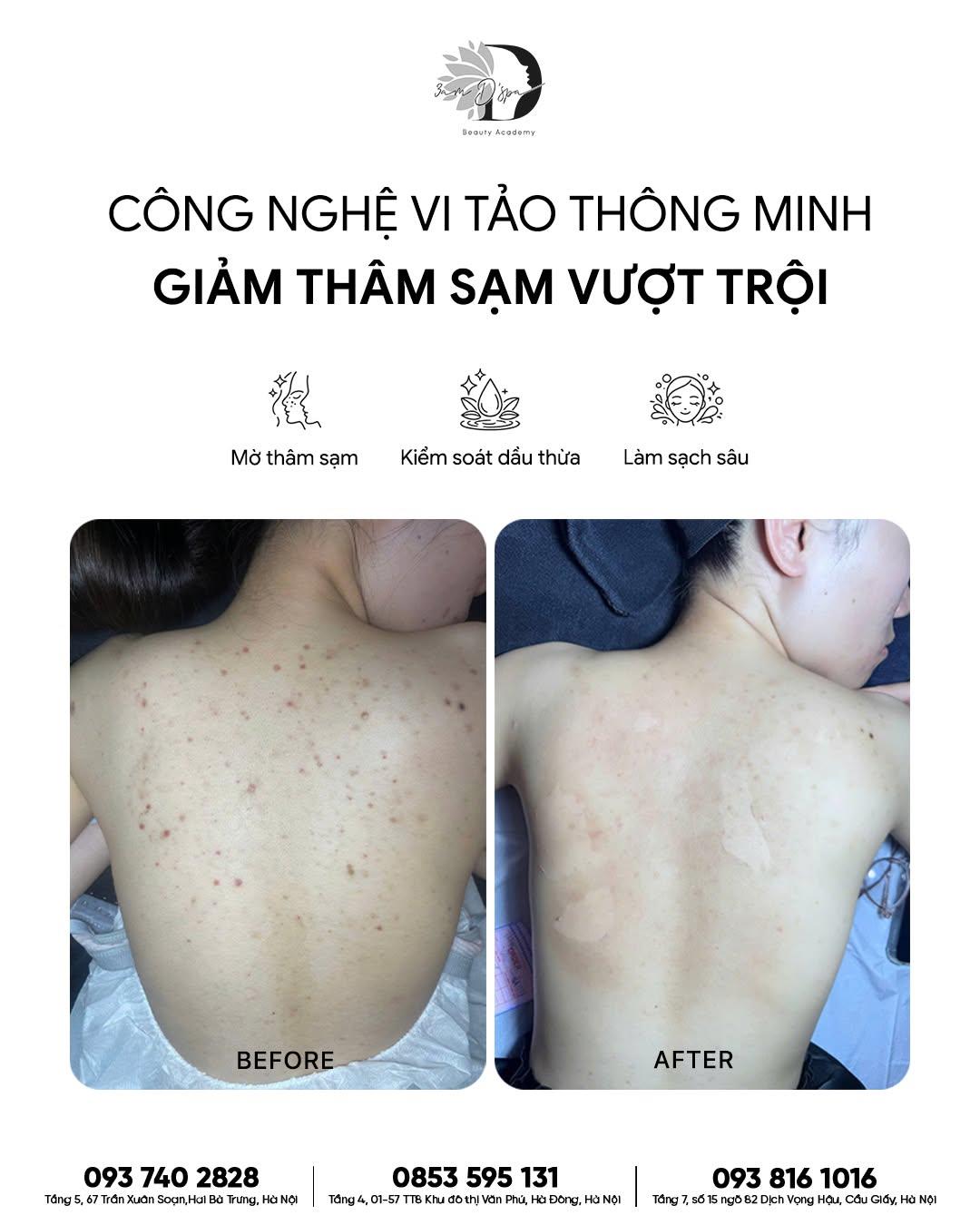 MÊ GYM, CHĂM PILATES MÀ NGẠI DIỆN SPORT BRA VÌ... THÂM LƯNG? 