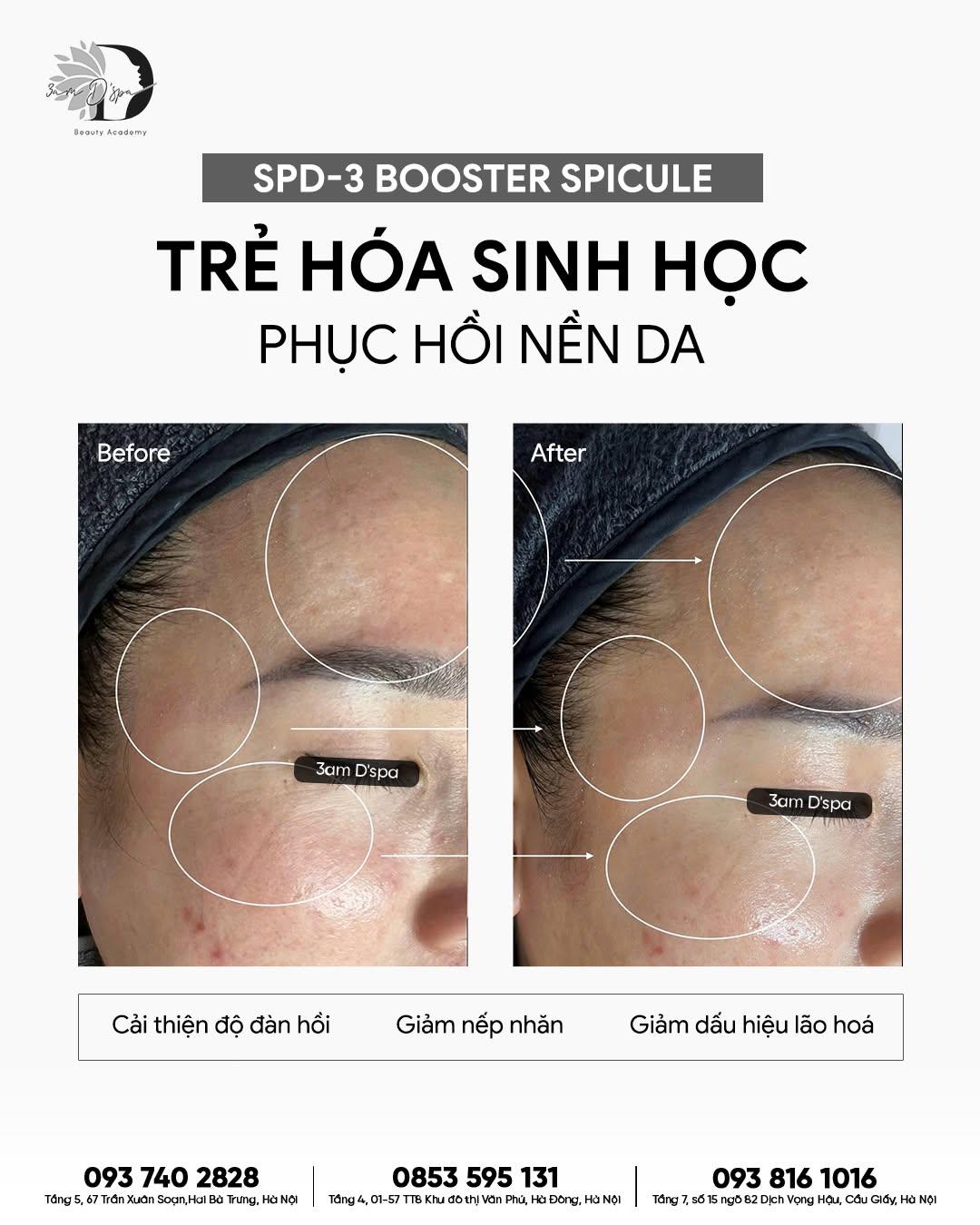 Team da nhạy cảm, dễ đỏ rát mỗi lần dùng BHA hay treatment mạnh thường rất 